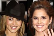 celebrities-gone-dental-before-and-after-photos-of-toothy.